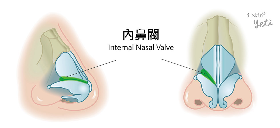 內鼻閥結構